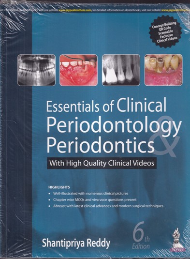 ESSENTIALS OF CLINICAL PERIODONTOLOGY PERIODONTICS | JAYPEE