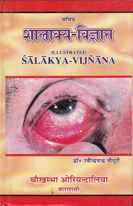 सचित्र शालाक्य-विज्ञान - आयुर्वेद | चौखम्बा ओरियन्टलिया (Chaukhamba Orientalia)