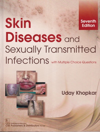 SKIN DISEASES AND SEXUALLY TRANSMITTED INFECTIONS | UDAY KHOPKAR | CBS