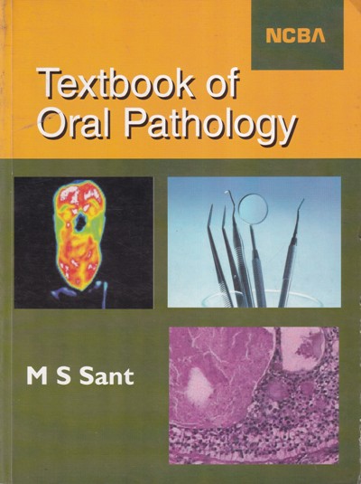 TEXTBOOK OF ORAL PATHOLOGY | M. S. SANT | NCBA